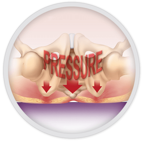 Pressure ulcers: prevention and management